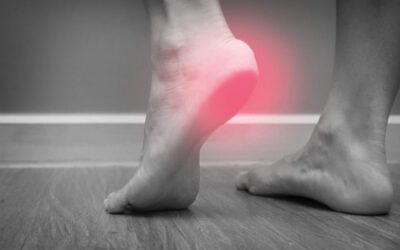 Bowen wirkt bei Fersenschmerz, Fersensporn, Entzündung Plantar Fasciitis